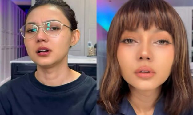 Rina Nose Akui Depresi Pasca Oplas Hidung